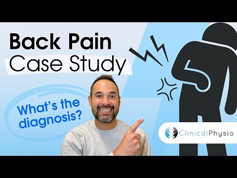 Low Back Pain Case Study | Expert Physio explains assessment, clinical reasoning and diagnosis!