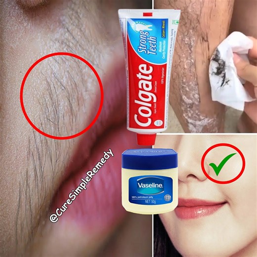 19K views · 130 reactions | Stop shaving! Here's how to permanently get rid of facial and body hair painlessly | Cure Simple Remedy | Facebook