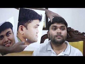 Major Upper Jaw Augmentation with Bone Grafting & Genioplasty Surgery