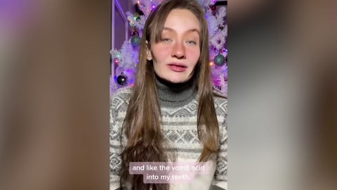 I was toothless with dentures at 19 — but I won’t hide my smile