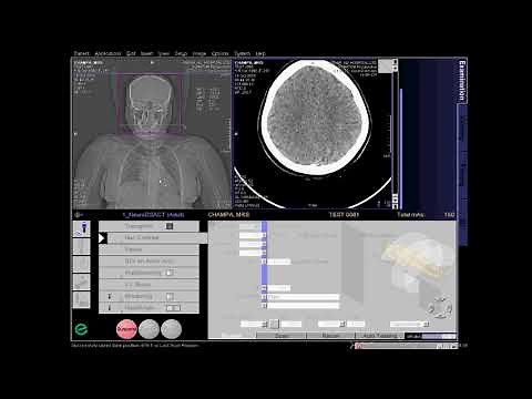 CT Cerebral Angio Full Work Process (SIEMENS) in syngo acquisition workplace