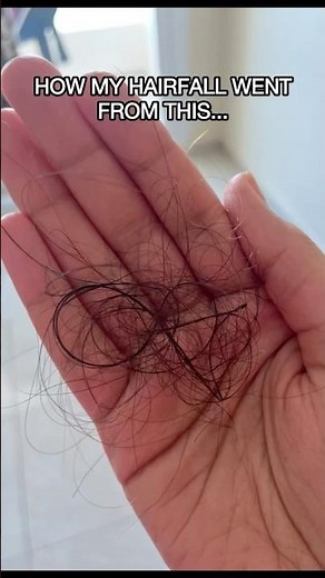 How to stop hair fall and regrow hair? Dermatologist explains. Best hair loss treatment | Hair care