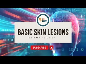 Basic Skin lesions | Dermatology | MBBS | Primary and Secondary Lesions