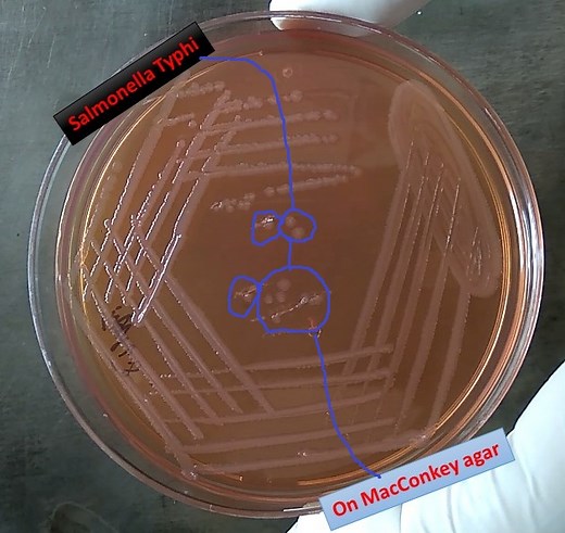 Salmonella on MacConkey agar and its Pathogenecity, Laboratory Diagnos