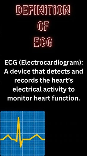 Electrocardiogram (ECG) | Simple Definition Explained