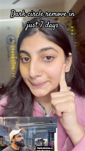 Dark Circles Home Remedy | Nitish Soni Inspired Natural Under Eye Treatment