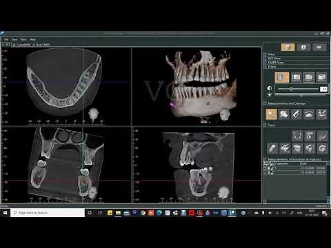 CBCT SOFTWARE DEMONSTRATION