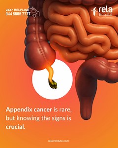 Appendix cancer is rare, but early awareness is key. This August, let’s support Appendix Cancer Awareness Month and encourage everyone to stay informed. If unusual symptoms persist, consulting your doctor can make all the difference. Share to help spread awareness and save lives! #AppendixCancerAwareness #KnowTheSigns #AugustAwareness #StayInformed #SupportEarlyDetection #RelaHospital | Rela Hospital