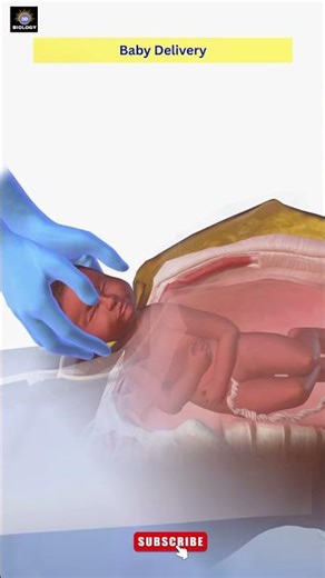 Cesarean Section (C-Section)