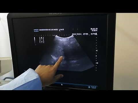 Ecografía básica abdominal
