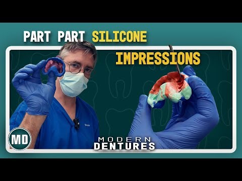 How to Take Part-Partial Silicone Impressions for Dentures | Modern Dentures