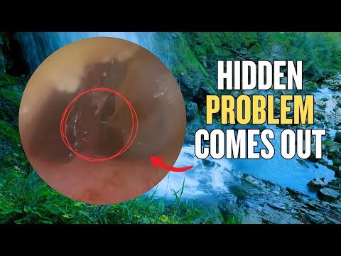 No One Expected This to Come Out!