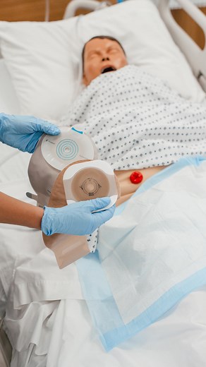 91K views · 1K reactions | Types of Ostomies Explained‍⚕️...