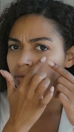 Tips to get rid of pimples in 5 minute