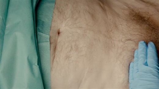 #suprapubiccatheter #surgery #meded | Osgenic