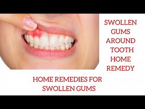 Swollen gums around tooth home remedy | Home Remedies for Swollen Gums