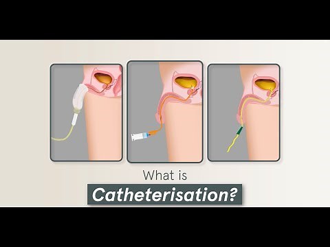 4 Minute Learning: Urinary Catheterisation (Male) & Care