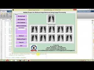 Image Retrieval Using Matlab Project with Source Code Final Year Project