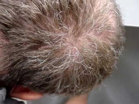 Installing Drawer Slides the easy way