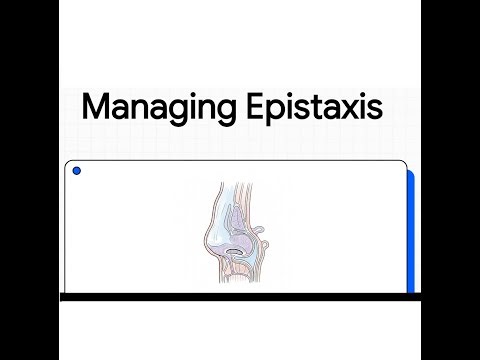 Managing Epistaxis (Nosebleeds): A Practical Clinical Guide for Medical Professionals