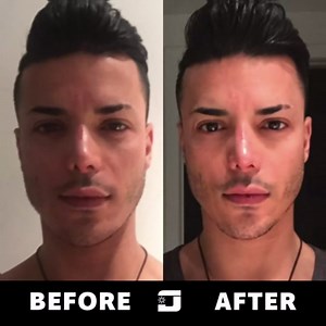 Jawzrsize Jaw, Face, and Neck Exerciser - Define Your Jawline, Slim and Tone Your Face, Look Younger and Healthier - Helps Reduce Stress and Cravings - Facial Exerciser (Level 4 - Elite) (Green)