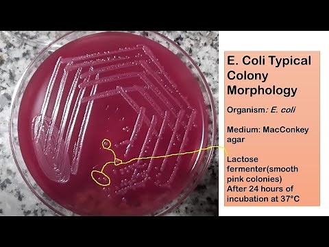 E coli typical colony morphology on Macconkey agar