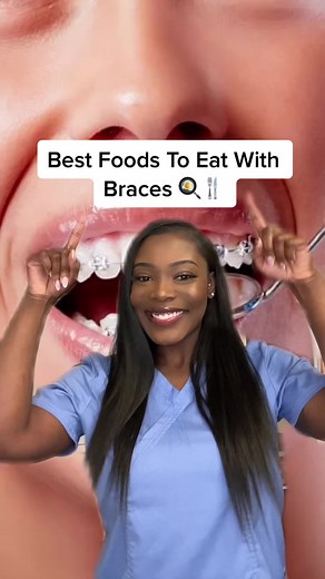 Best Foods to Eat With Braces