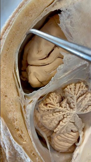 Incredible Tissue Surrounding Your Brain | Institute of Human Anatomy