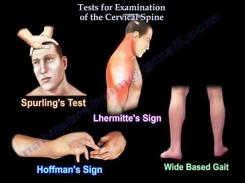 Tests For Examination Of The Cervical Spine - Everything You Need To Know - Dr. Nabil Ebraheim