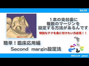 【exocad】簡単！臨床応用編 second margin設定法