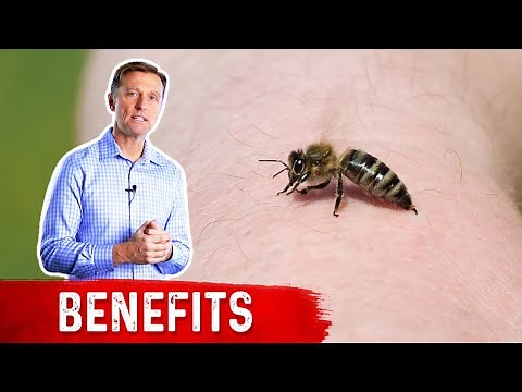 Bee Sting Therapy