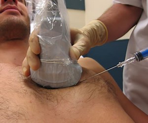 Ultrasound Guided Pericardiocentesis