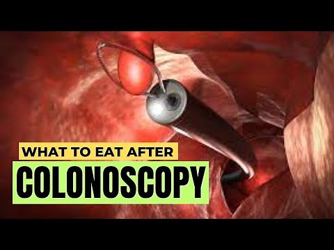 TOP 3 Foods to Eat Immediately After a Colonoscopy for Fast Recovery