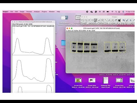 How to Quantify Western Blots Using ImageJ | Step by Step Densitometry Tutorial for Beginners