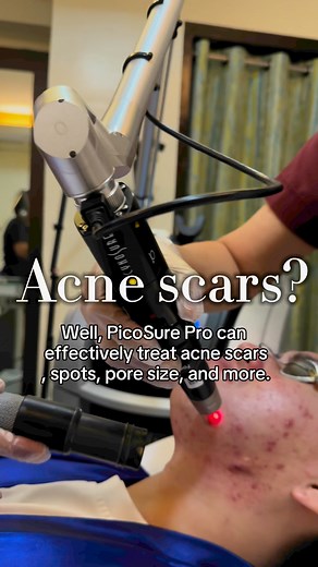 1.4K views | TREATING THE WORSE ACNES / Cystic acne is debilitating -...