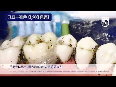 フィリップス ソニッケアーの音波水流