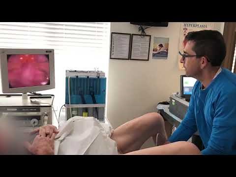 Dr. Z performs Rezum procedure on patient