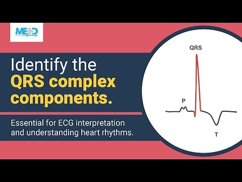 Identifying components of the QRS complex