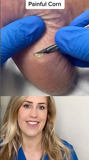 A satisfying removal