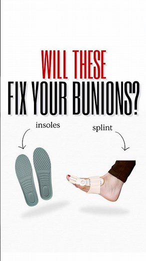 Bunion correctors! Do they really work? Podiatrist compares Bunion Splint vs Custom Foot Orthotics!
