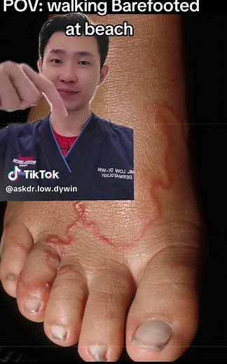 Understanding Cutaneous Larva Migrans: Symptoms, Treatment, and Prevention