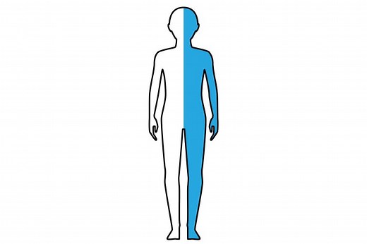 Right Hemiplegia: Causes, Recovery Outlook, and Treatment - Home Recovery for Stroke, Brain Injury and More