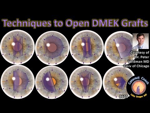 Techniques to Open DMEK grafts (corneal endothelial transplantation)