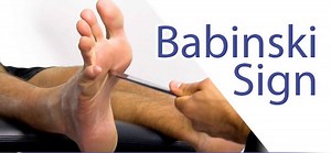 Babinski reflex test & causes of positive Babinski reflex in adults