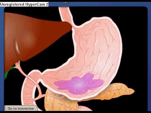 The digestion process - What happens to your food as it travels through your body until it exits?