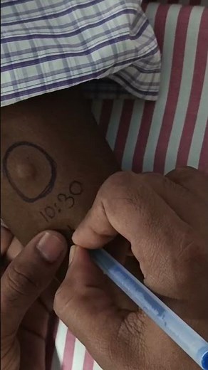 Mantoux test, also known as a tuberculin skin test (TST), is a skin testthat tuberculosis (TB):