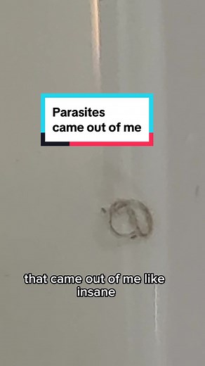 Parasite Cleanse Foot Soak: Removing Parasites Naturally