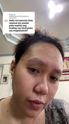 Eyebrow Tattoo Laser Removal Process Explained