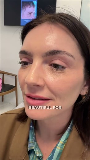Upper blepharoplasty- testimonial