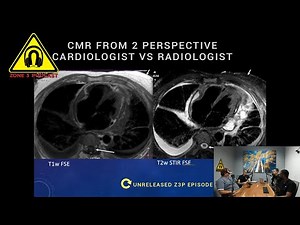 Cardiac MR from 2 Perspectives a Cardiologist vs Radiologist